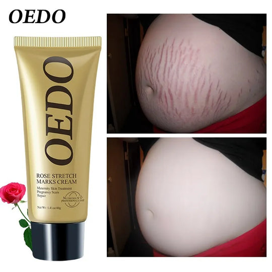 Rose Stretch Mark Cream Pregnant Women Repair Cream