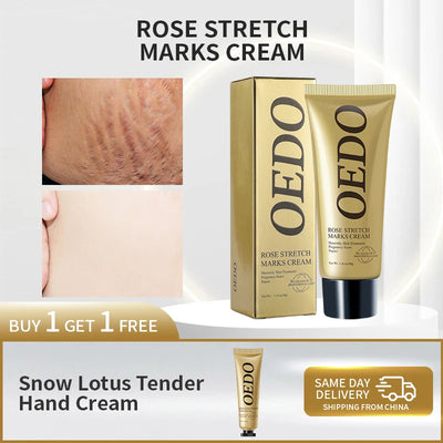 Rose Stretch Mark Cream Pregnant Women Repair Cream